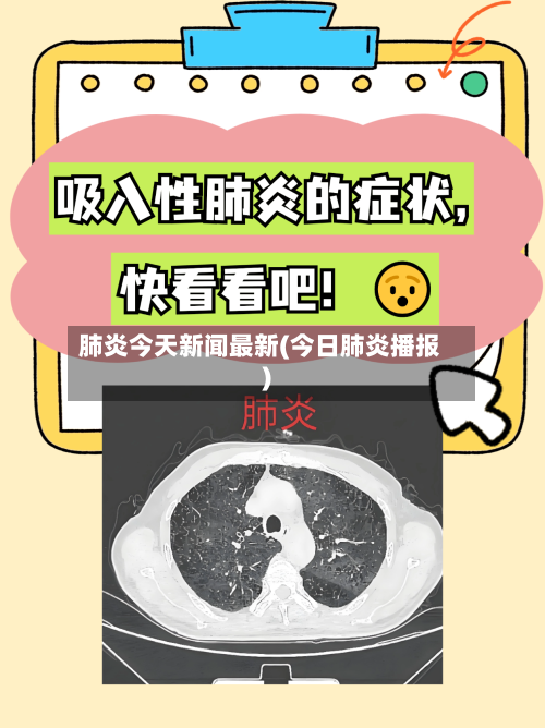 肺炎今天新闻最新(今日肺炎播报)